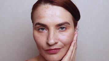 Red hair womans face with pigmentation, melasma, freckles, age spots photo. Close up footage video