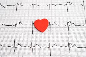 Electrocardiogram ECG heart wave, heart attack cardiogram photo