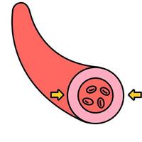 Vessel Spasm Illustration vector