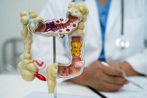 Intestine, appendix and digestive system photo