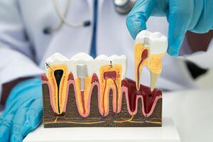 Asian dentist holding dental implant, artificial tooth roots into jaw, root canal of dental treatment, gum disease, teeth for dentist. photo