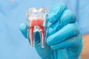 dentist holding dental implant, artificial tooth roots into jaw, root canal of dental treatment gum photo