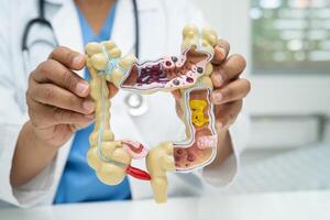 Intestine appendix and digestive system, doctor holding anatomy model for study diagnosis treatment photo