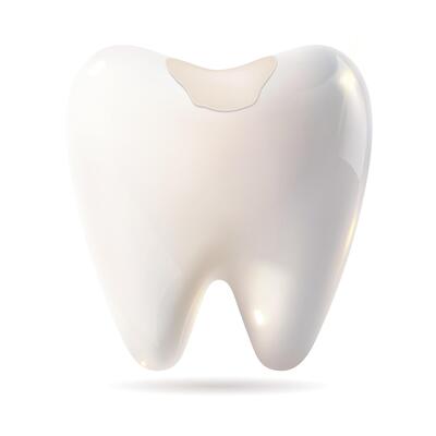 A white tooth showing a hole in its surface against a white background