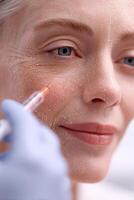 Woman getting facial skin treatment injection photo