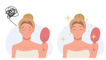 Skin care concept.woman,girl with acne. Before and after acne.Flat 2d cartoon character illustration. vector