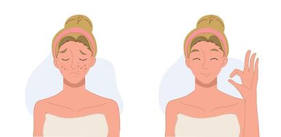 Skin care concept.woman,girl with acne. Before and after acne.Flat cartoon character illustration. vector