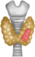 Hand drawn watercolor illustration of thyroid cancer png
