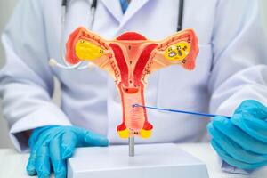 Doctor holding human uterus model for vaginal and cervix pap smear check up in the obstetrics and gynecology. photo
