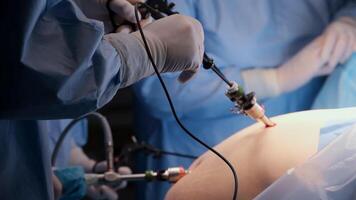 professionell medicinsk team utför minimalt inkräktande laparoskopisk kirurgi använder sig av specialiserade instrument och Avancerad teknologi i modern rörelse rum video
