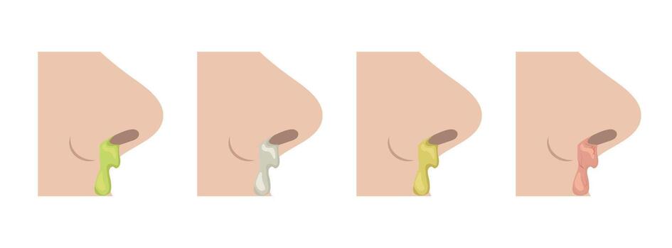 Four noses showing different colors of snot, varying degrees of infection or cold, visual guide to understanding nasal mucus and health vector