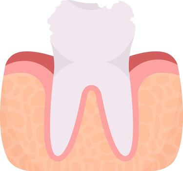 Decayed Tooth Problem vector