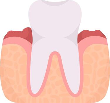 Gingivitis Tooth Problem vector