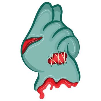 cartoon zombie hand in blue with open wounds and bones that folds into a clenched zombie fist gesture - a symbol of strength, rebellion or attack, design for Halloween vector