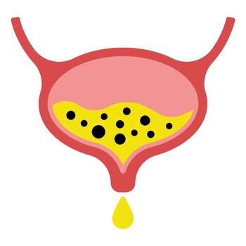 Urinary Bladder Icon. Line Illustration of Bladder Filled with Urine, Symbolizing Urology and Health Monitoring. Isolated Outline Sign. vector