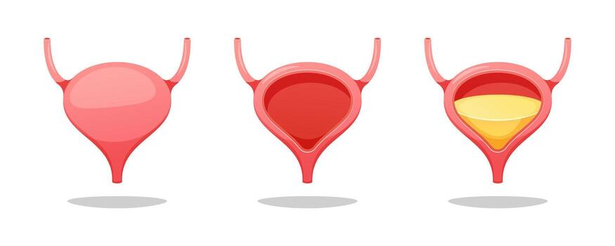 Illustration of urinary bladder stages vector