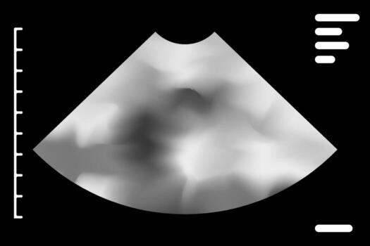 Grayscale ultrasound image revealing intricate anatomical structures, delivering essential medical insights for effective diagnosis and ongoing patient monitoring in healthcare settings vector