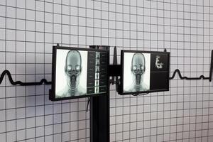 radiografía imágenes desplegado en monitores demostración humano cráneo y interno estructura. médico diagnóstico equipo para visita detallado imágenes de huesos y tejido. salud examen y imagen tecnología foto