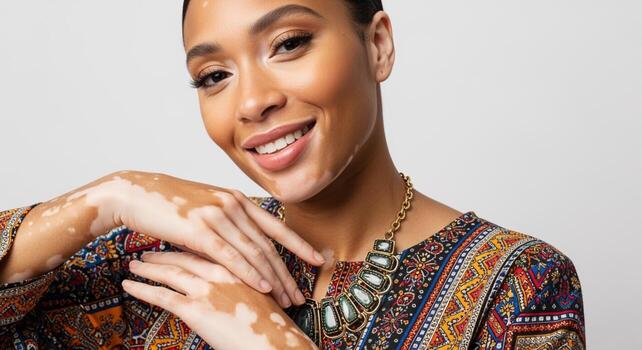 Beautiful woman with vitiligo smiling wearing a colorful patterned top and statement necklace. photo