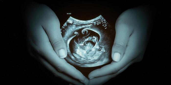 A nurturing pair of hands gently cradle an ultrasound image of a developing baby. photo