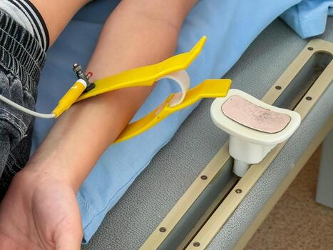 Close-up of a child's hand with ECG electrodes attached for heart monitoring photo