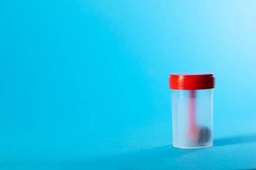 Sterile container with stool test on a blue background. Concept of stool analysis for occult blood and dysbacteriosis. Copy space for text, microbiological photo