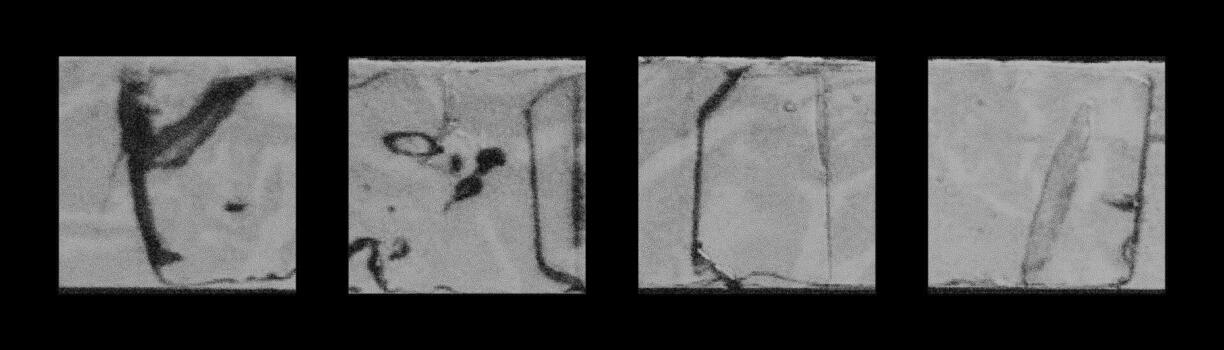 Set of distressed monochrome backgrounds with noise texture featuring square shapes and various patterns suitable for design and artistic projects. vector