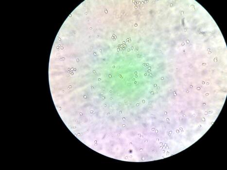 Exploring Diverse Microbes Under a Microscope in a Laboratory Setting photo