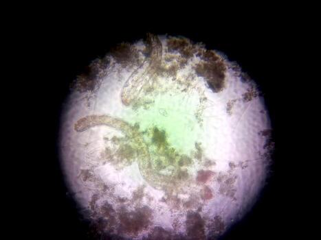 Nematode Germs Magnified Under Microscope Showing Structure and Habitat Details photo