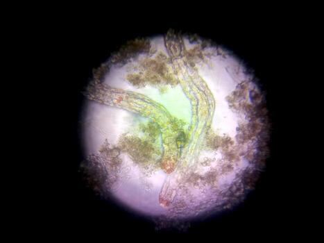 Exploring Nematode Germs Under a Microscope in a Laboratory Setting photo