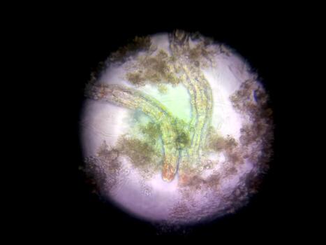 Microscopic View of Nematode Germs Displaying Distinctive Structures and Movement Patterns photo