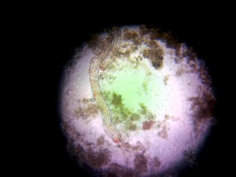 Microbial Life Observed Through a Microscope Showcasing Diverse Microorganisms and Structures photo