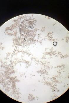 explorador el microbiano mundo mediante un lente de fascinante gusanos y su habitat foto