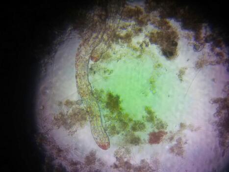 Nematode Germs Observed Under the Microscope in a Laboratory Setting photo