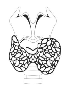 Enlarged thyroid gland affected by hyperthyroidism outline illustration. Hormone imbalance. Overactive disorder in neck anatomy 2D line object isolated on white. Monochrome ink linear image vector