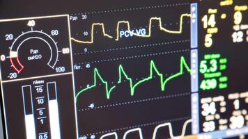 Curved lines moving slowly by the screen of operational room monitor. Multiparameter monitoring system close up. video