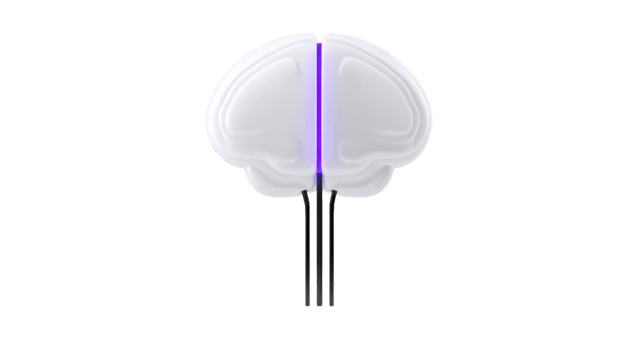Brain shaped object with glowing purple line, futuristic design, white plastic material, black wires, isolated on transparent background, symbolizing artificial intelligence and technology png