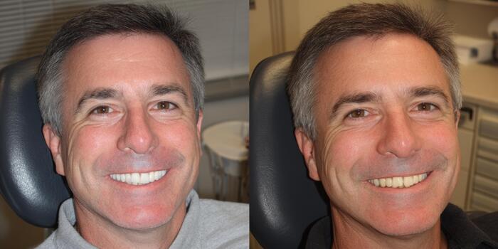 Smiling man showcases dental transformation in a clinic setting during a routine check-up photo