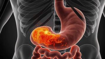 vicino su di un' salutare umano stomaco e intestini nel un' 3d rendere mostrando digestivo processi con raggiante arancia animato particelle che rappresentano cibo abbattersi entro il digestivo tratto video