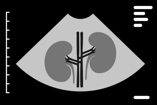 Medical ultrasound scan displaying human kidneys alongside a portion of the spine on a monitor, featuring a measuring scale in a detailed grayscale image vector