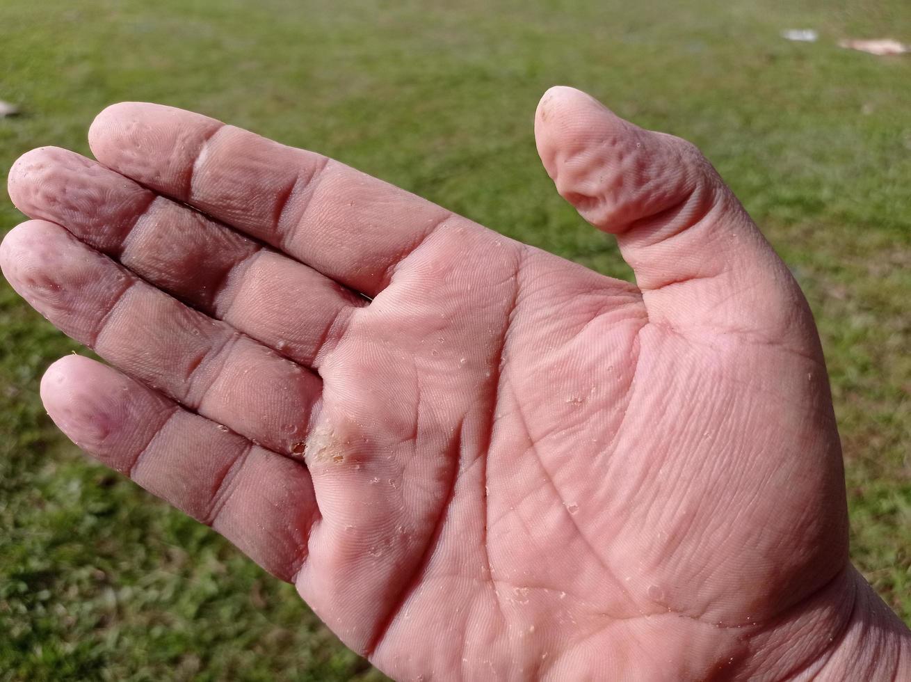 la pelle dei palmi è rugosa e bagnata dall'acqua, immersa nell'acqua per troppo tempo. foto