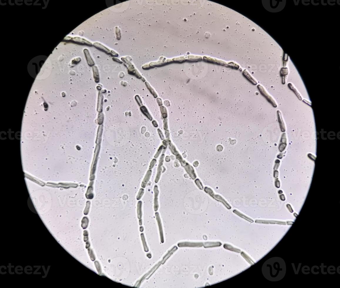 microfotografia mostrando ife di dermatofiti, chiodo raschiatura per fungo test foto