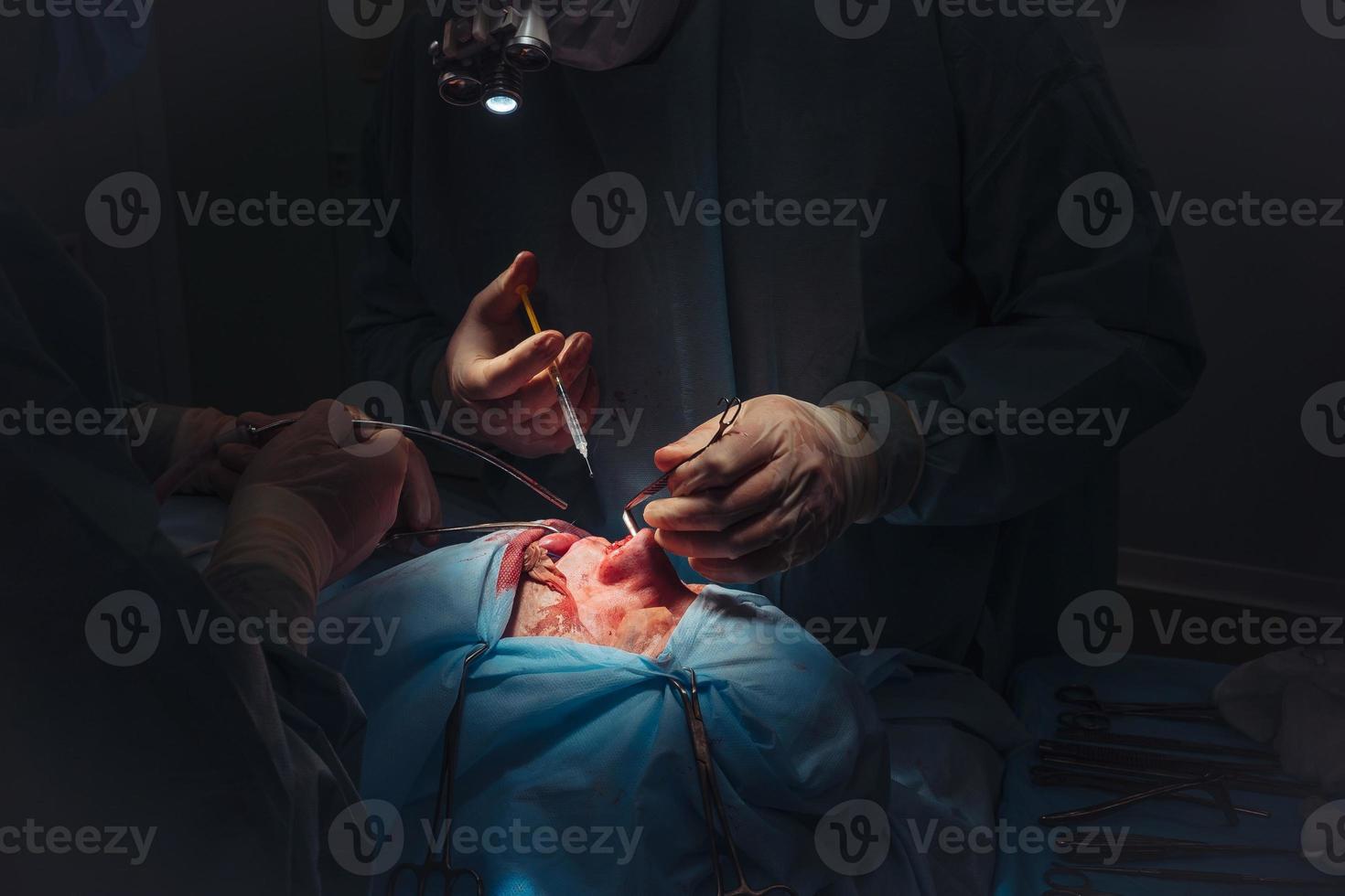 chirurgo e il suo assistente l'esecuzione cosmetico chirurgia su naso foto