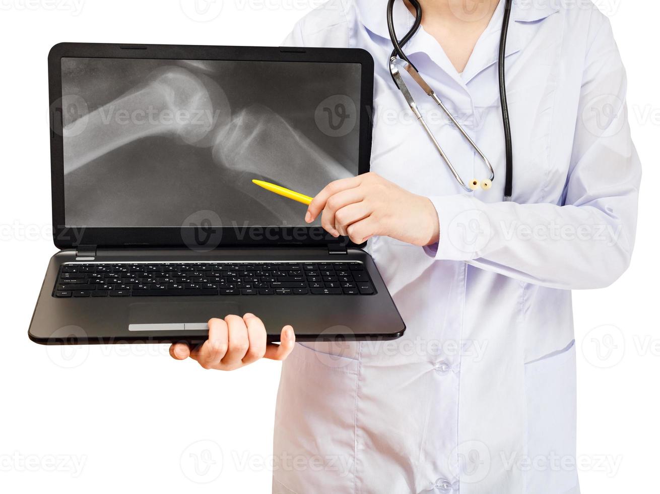 infermiera punti su computer il computer portatile con ginocchio comune foto