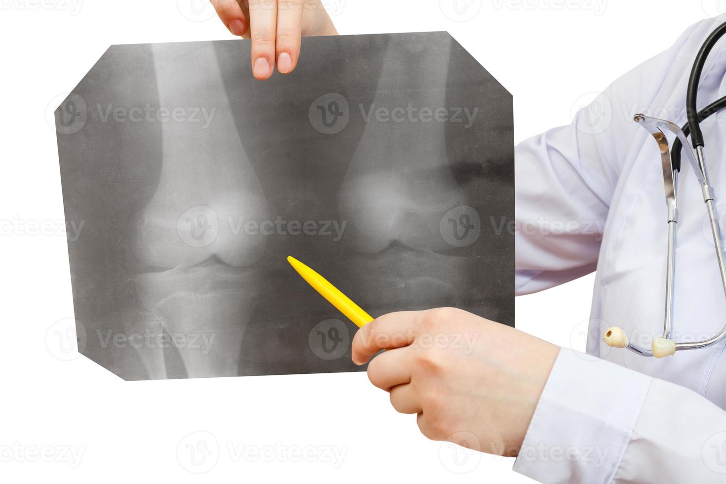 infermiera punti raggi X immagine con umano ginocchio comune foto