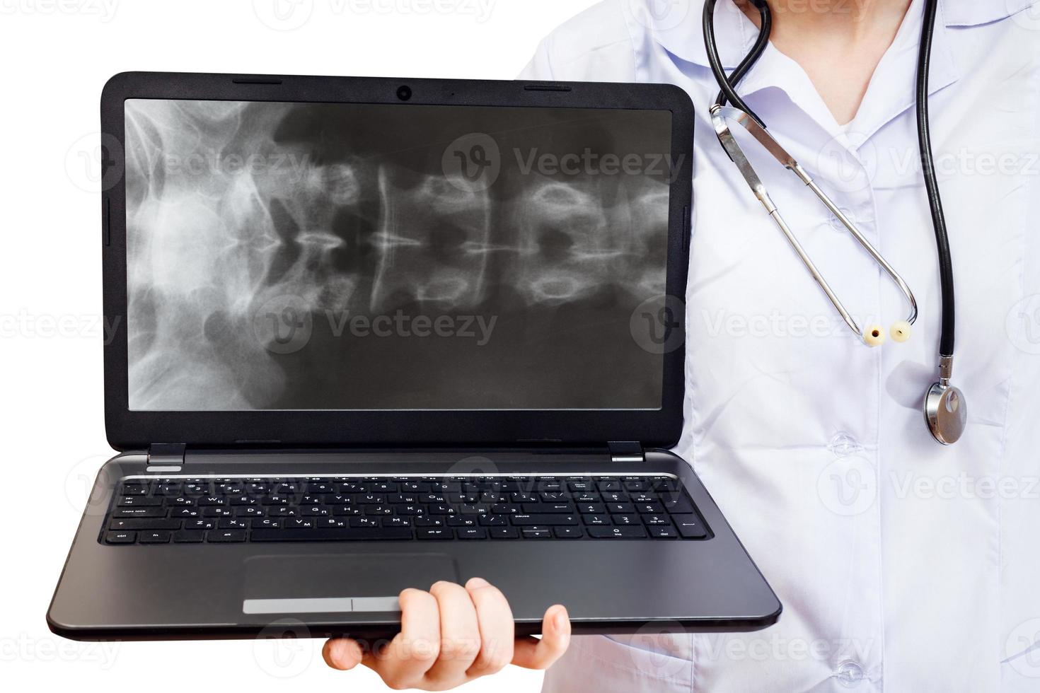infermiera detiene computer il computer portatile con spinale colonna foto