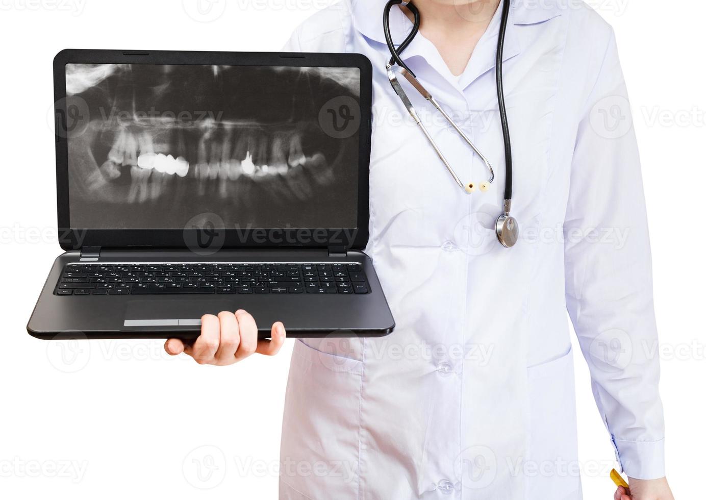 infermiera detiene computer il computer portatile con umano denti foto