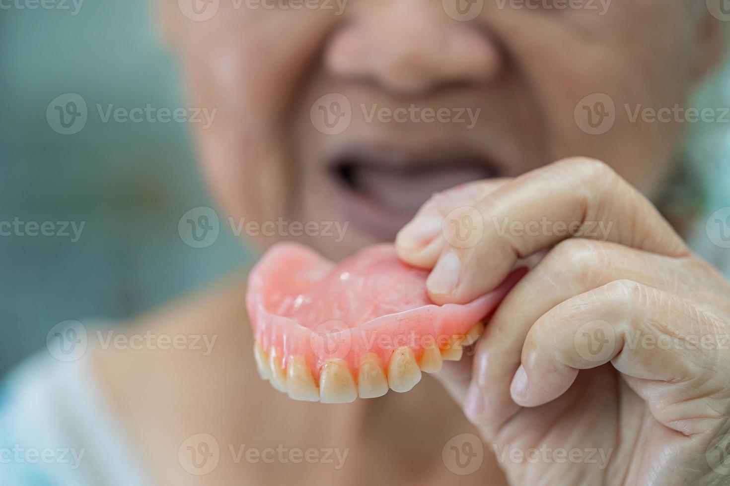 paziente anziana o anziana asiatica che tiene per usare la dentiera nel reparto ospedaliero di cura, concetto medico forte foto