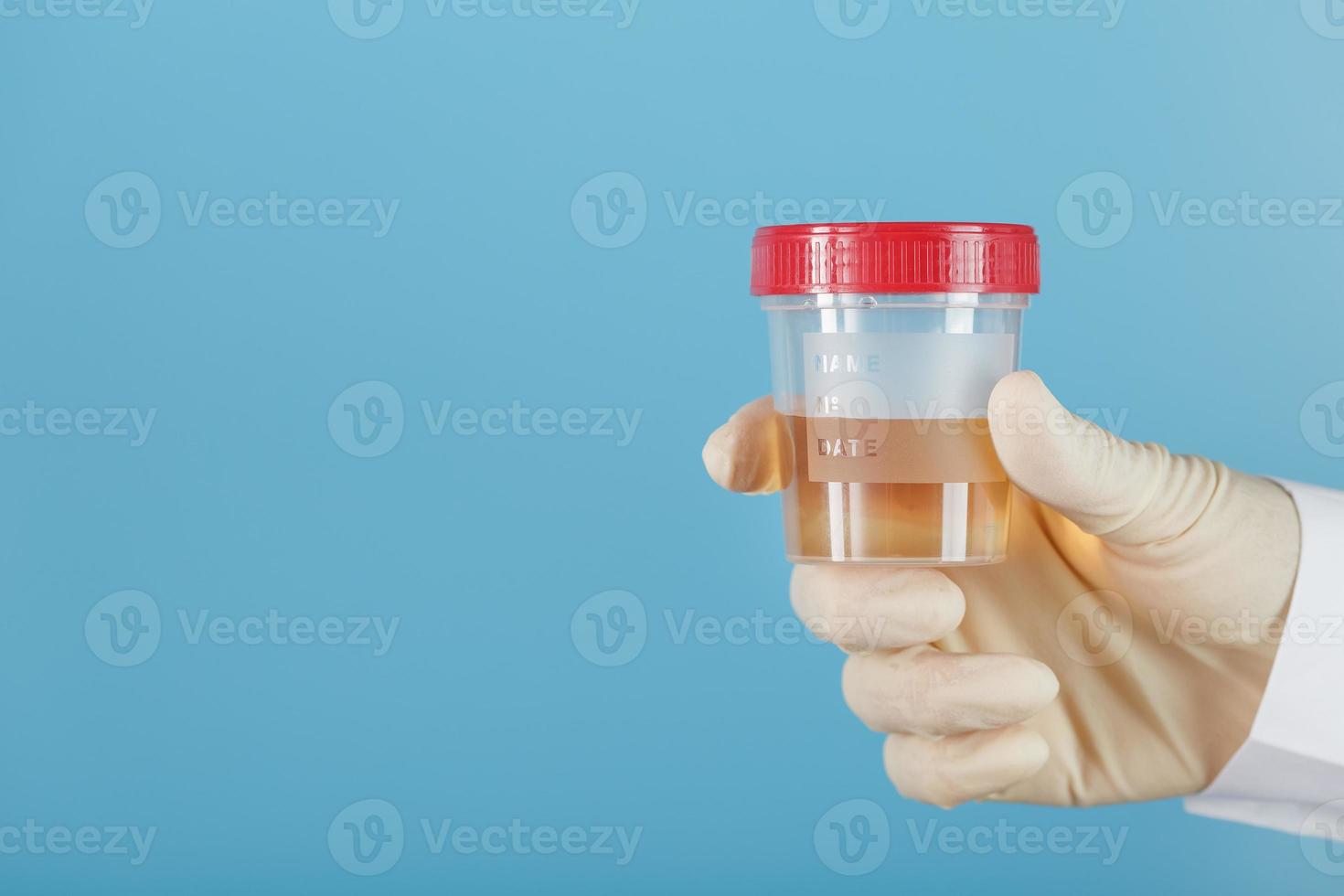 il medico guantato mano detiene un' trasparente contenitore con un' urina test. foto