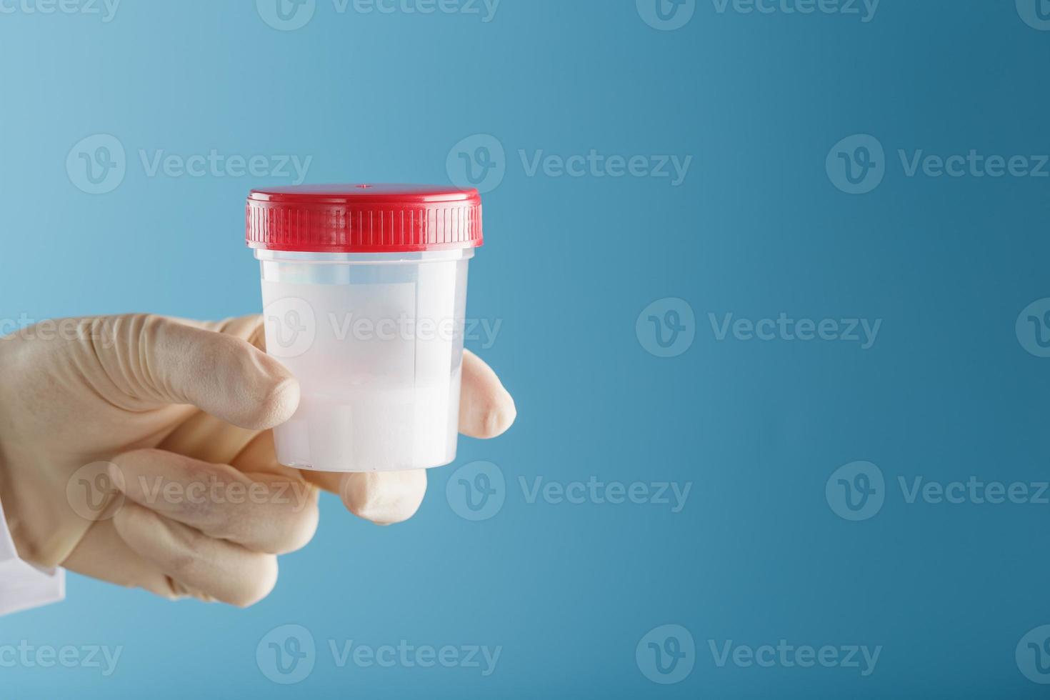 il medico detiene un' plastica vaso di sperma nel il suo mano per analisi. foto